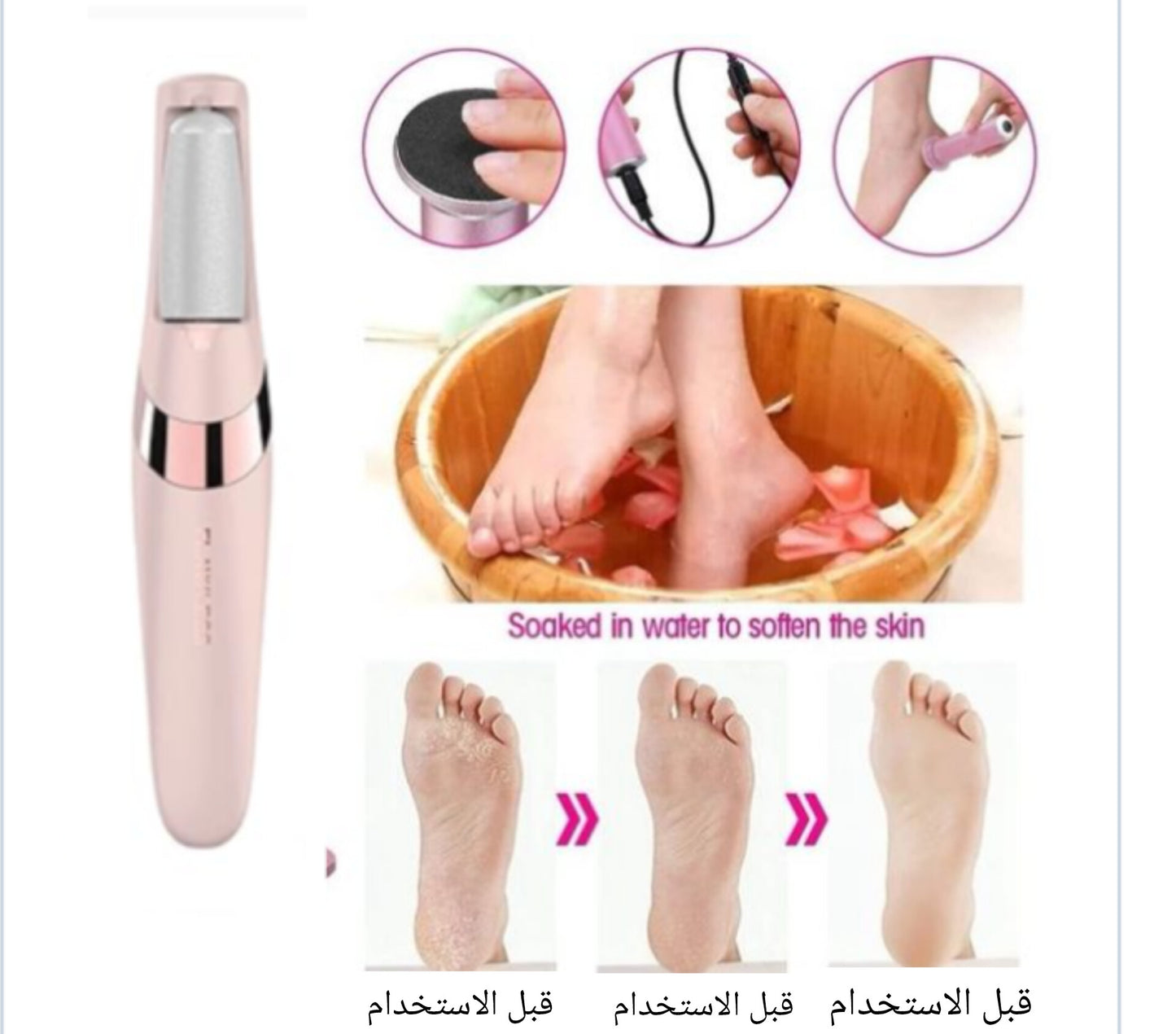 أجهزة إزالة مسامير القدم الكهربائية المتقدمة Advanced Electric Feet Callus Removers