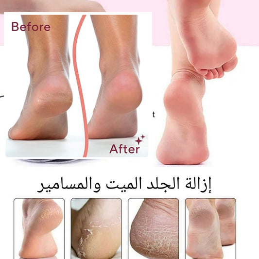أجهزة إزالة مسامير القدم الكهربائية المتقدمة  Advanced Electric Feet Callus Removers